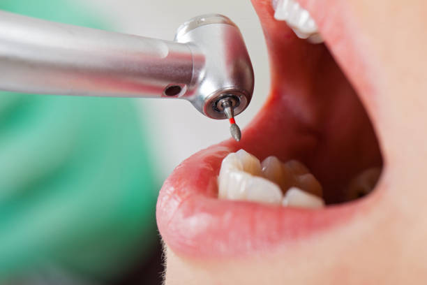 Best Tooth Pain Emergency Relief  in Riverdale Park, CA